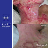 Rejuvaskin Scar Fx Silicone Sheeting - 1.5" x 3" - 100% Healthcare Grade Silicone - Physician Recommended